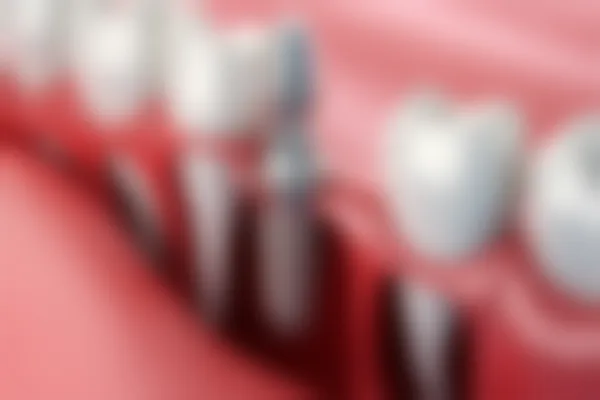 呼和浩特亚非口腔门诊部拔牙价格表：原价500元起，现仅需350元起优惠活动！