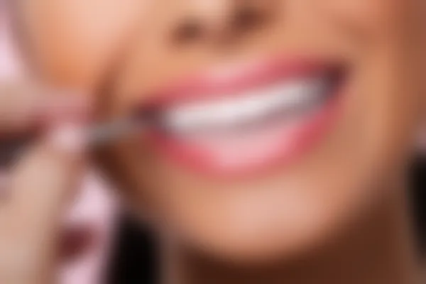 微笑时代口腔门诊部提供的口腔修复服务，原价3000元起，现在仅需2500元起，助您拥有健康美丽的笑容！