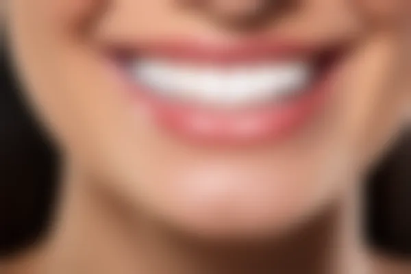 鄂州中山口腔医院推出限时优惠活动，烤瓷牙仅需2500元起，原价3000元起，尽享超值体验！