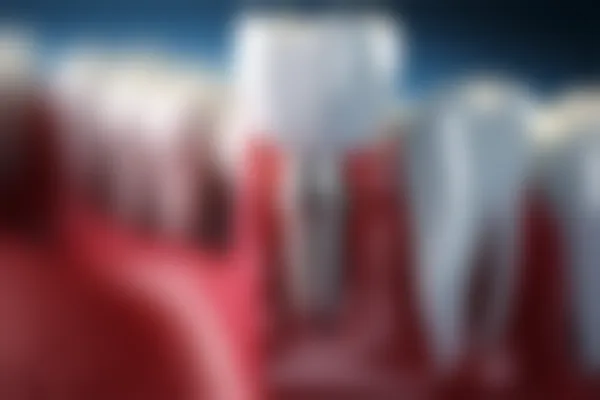 东莞爱雅健口腔门诊部牙周治疗现推出限时优惠，原价800元起特价仅需600元起！抓住机会，享受健康呵护！