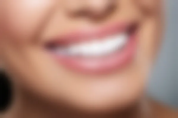 宁波鄞州益贝口腔门诊部种植牙优惠活动：原价9800元起，现仅需7800元起，限时促销，优异机会！