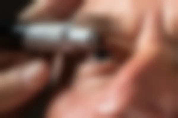 30岁的人还能够接受斜视手术吗？了解斜视手术的适应症与结果。