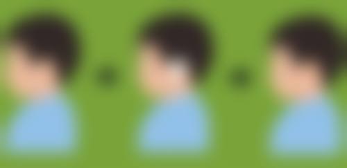 不同来源资料提及的面部填充脂肪维持时间是多久？