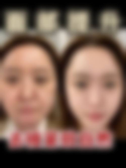 北京加减美医疗美容医院面部拉皮提升，服务特色体现在哪些方面呢？