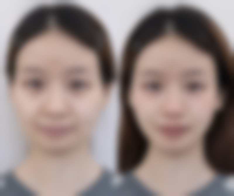 苏州常春藤林德金医生怎么样？