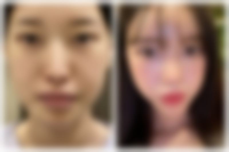 宁波午月医疗美容诊所怎么预约