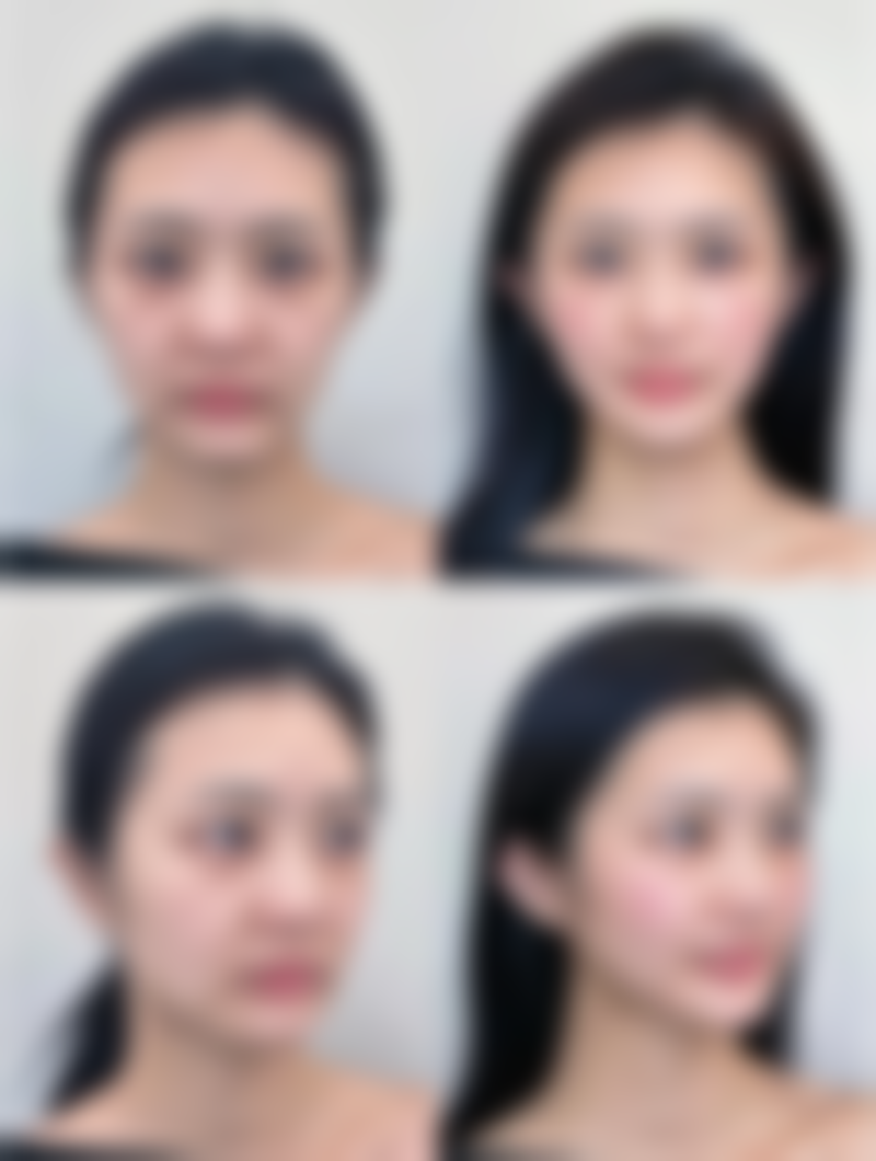 长沙彭栋梁医疗美容诊所怎么样收费价格表