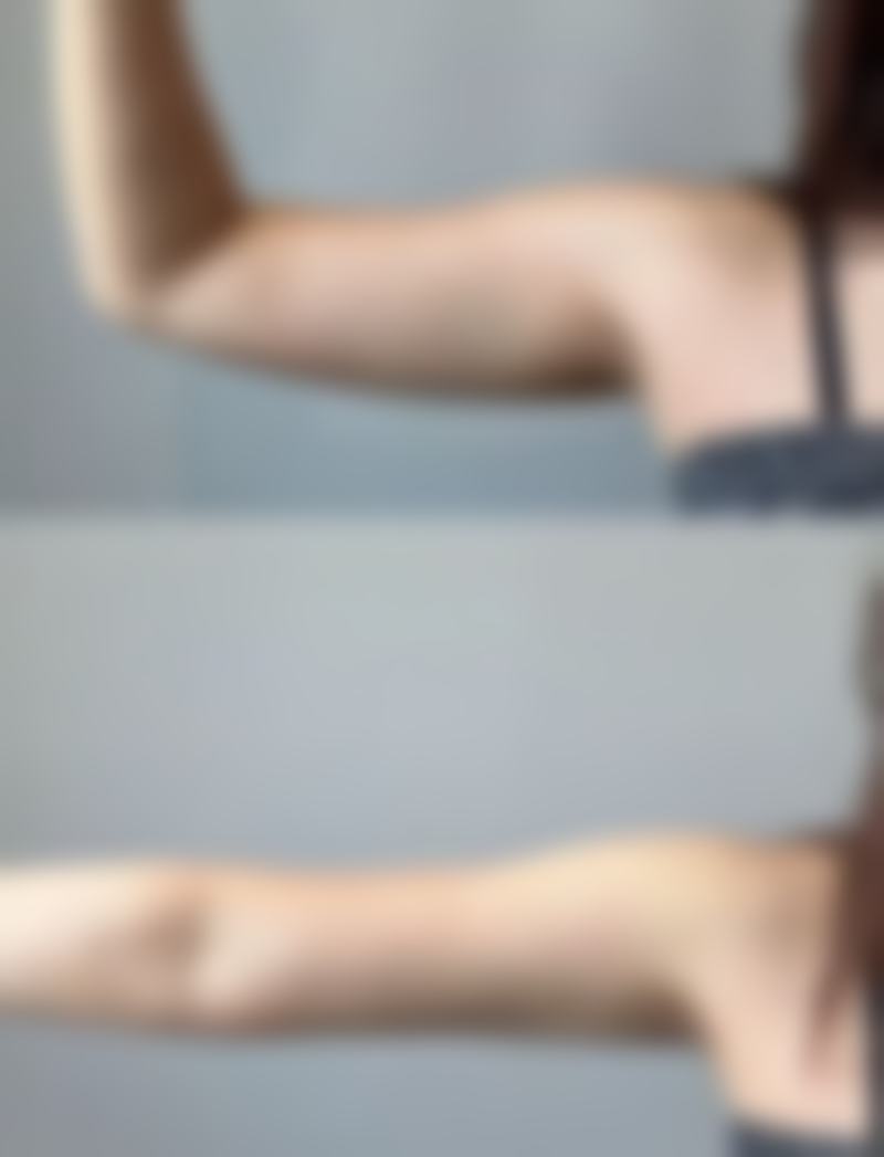 武汉一美整形医疗美容门诊部收费价格表