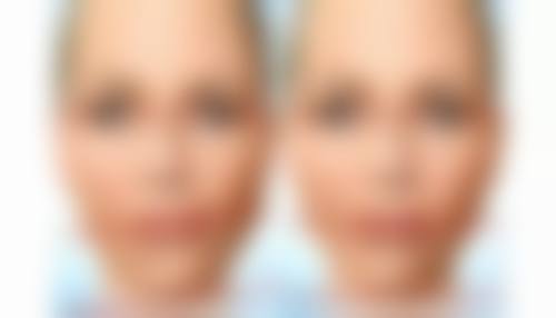 南京连天美医疗美容医院厉立辉医生擅长项目