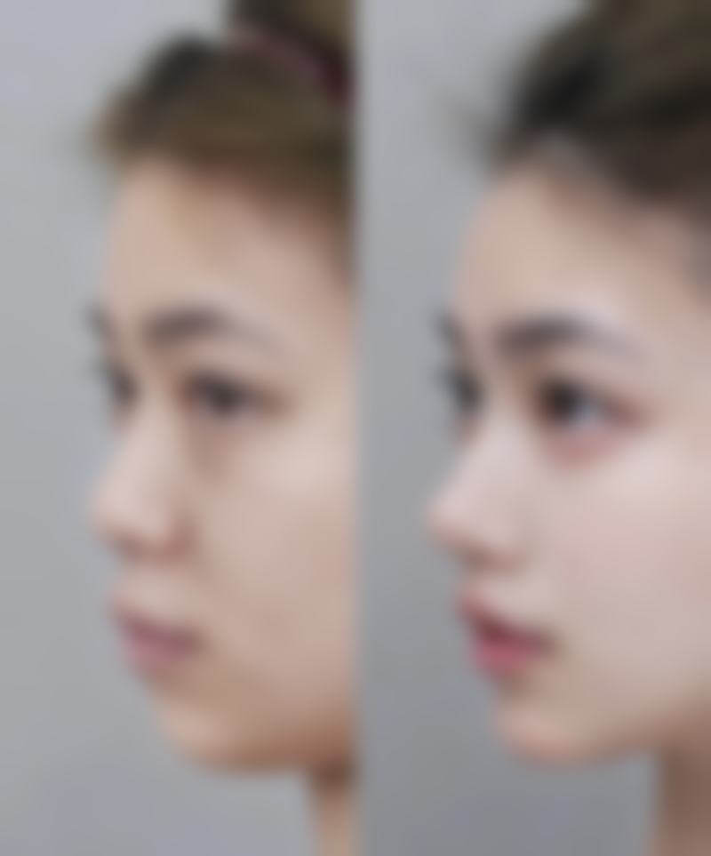 内江瑞美医疗美容门诊部怎么样口碑评价怎么样