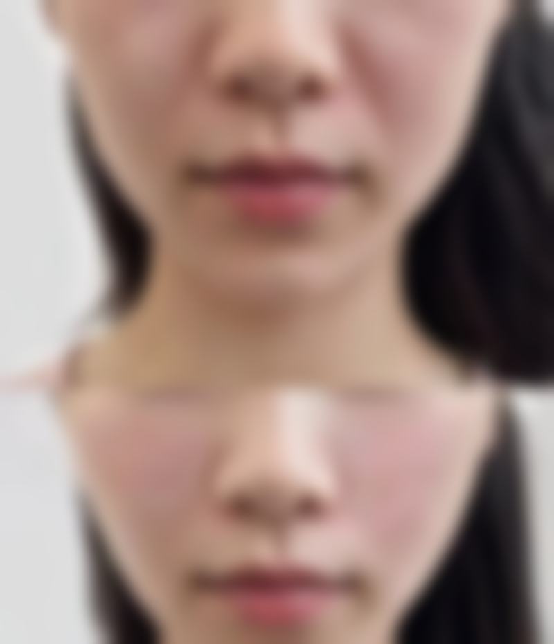 石首华美整形医院杨若国医生预约挂号指南