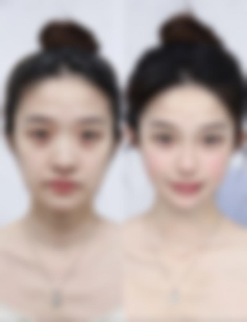 武汉丽比雅医疗美容门诊部叶兰医生患者评价