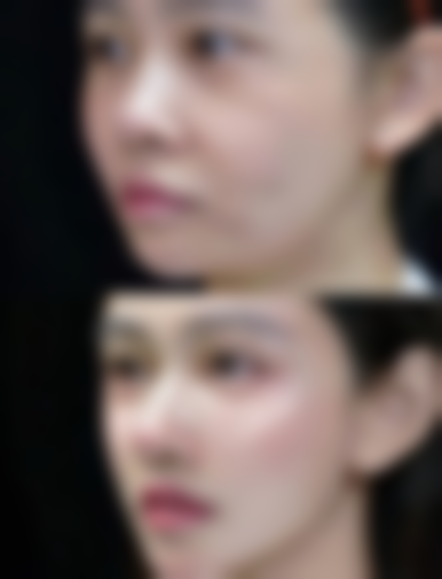 韩国Aloha皮肤科怎么样口碑评价怎么样