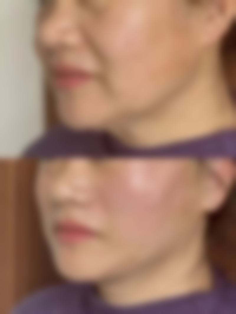 韩国皮克瑟整容外科林志润医生预约挂号指南