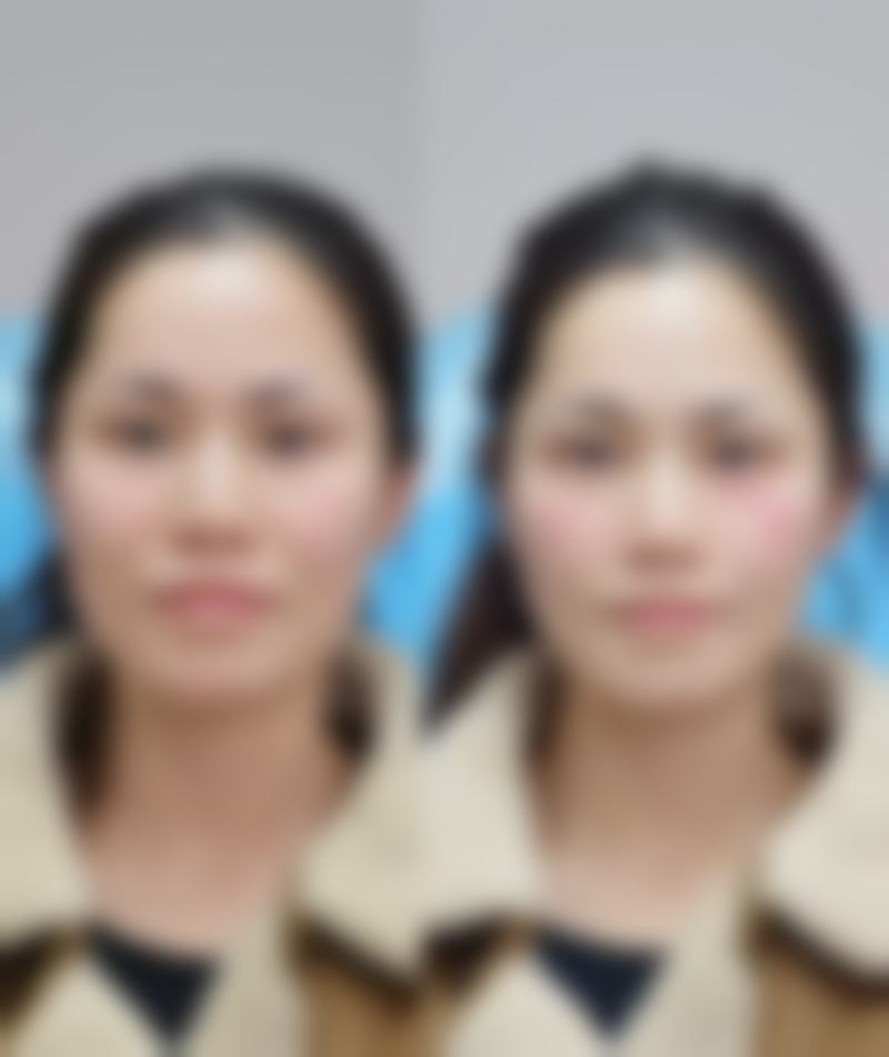 韩国丽珍整形医院收费价格表