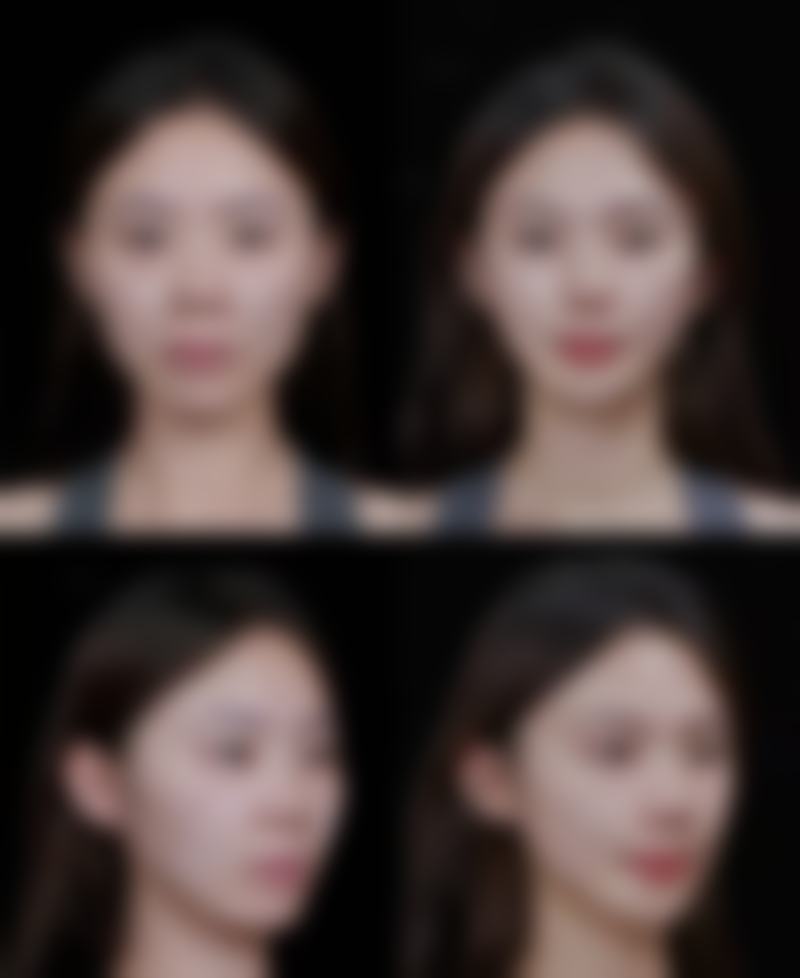 西安晶肤医疗整形美容连锁上市机构怎么预约