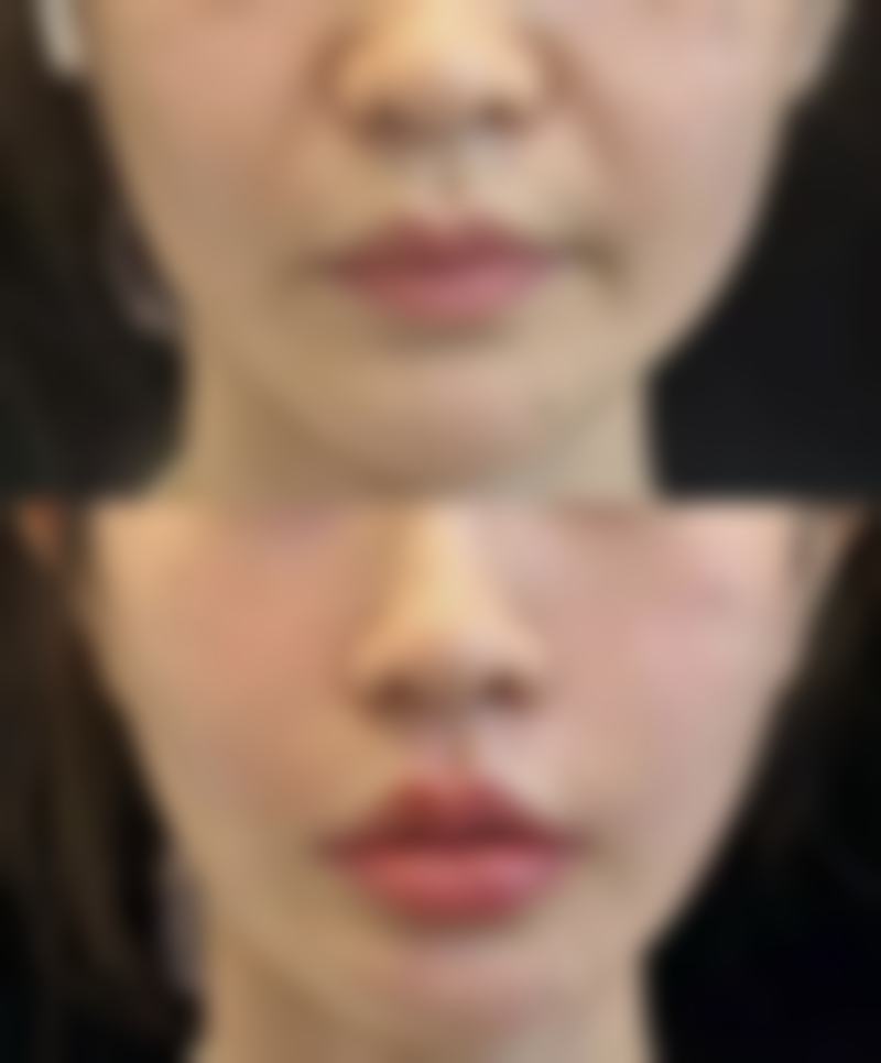 成都美懿美辰整形医院怎么预约