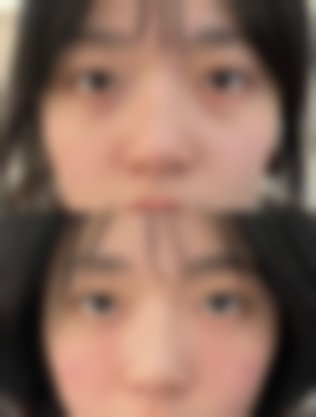 昆山百达丽医疗美容门诊部柯文英医生祛斑技术怎么样？