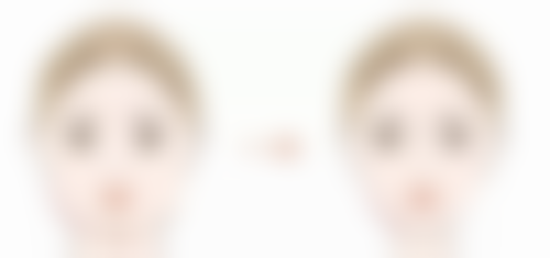 西宁市第一人民医院（医疗美容科）怎么预约