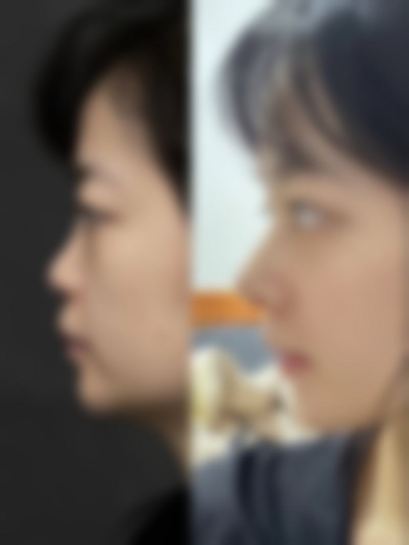 长沙艾泊医疗美容怎么样口碑评价怎么样