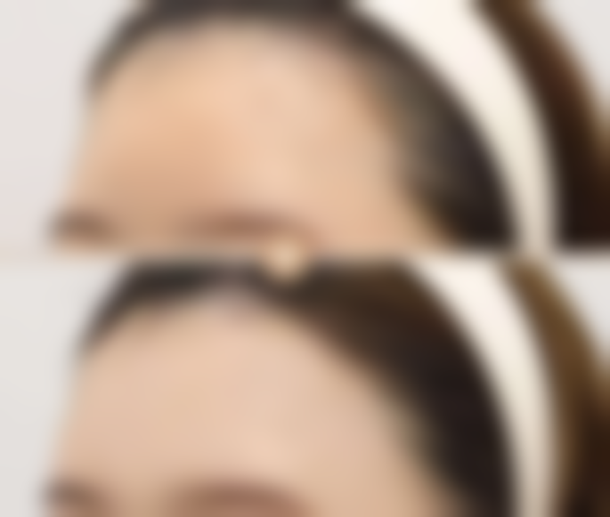 长沙伊雅医疗美容诊所怎么预约