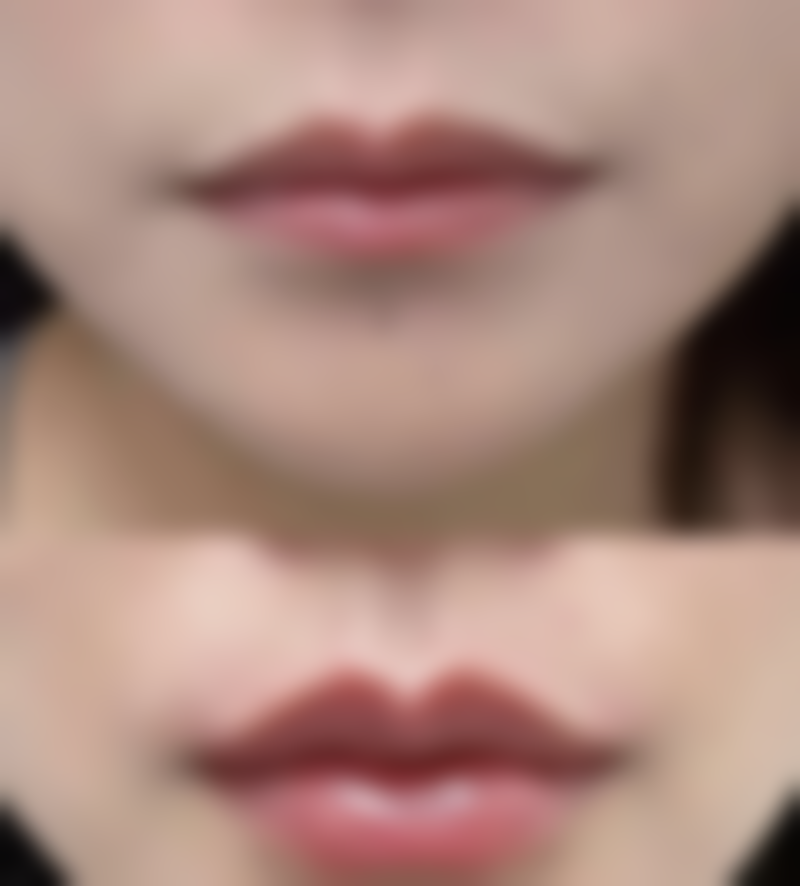 武汉善美整形美容医院正规吗？