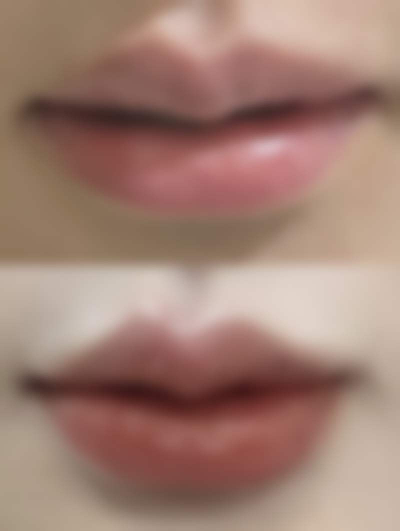 惠州惠阳人民医院烧伤整形科收费价格表