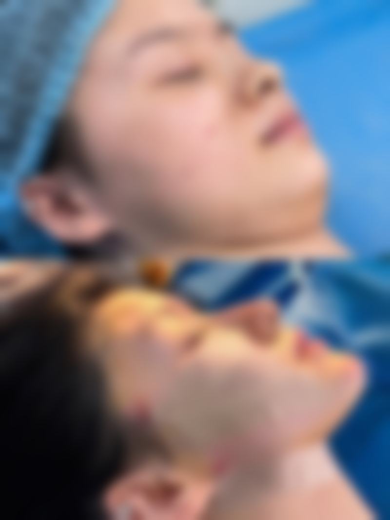 武汉甄美医疗美容整形医院怎么预约