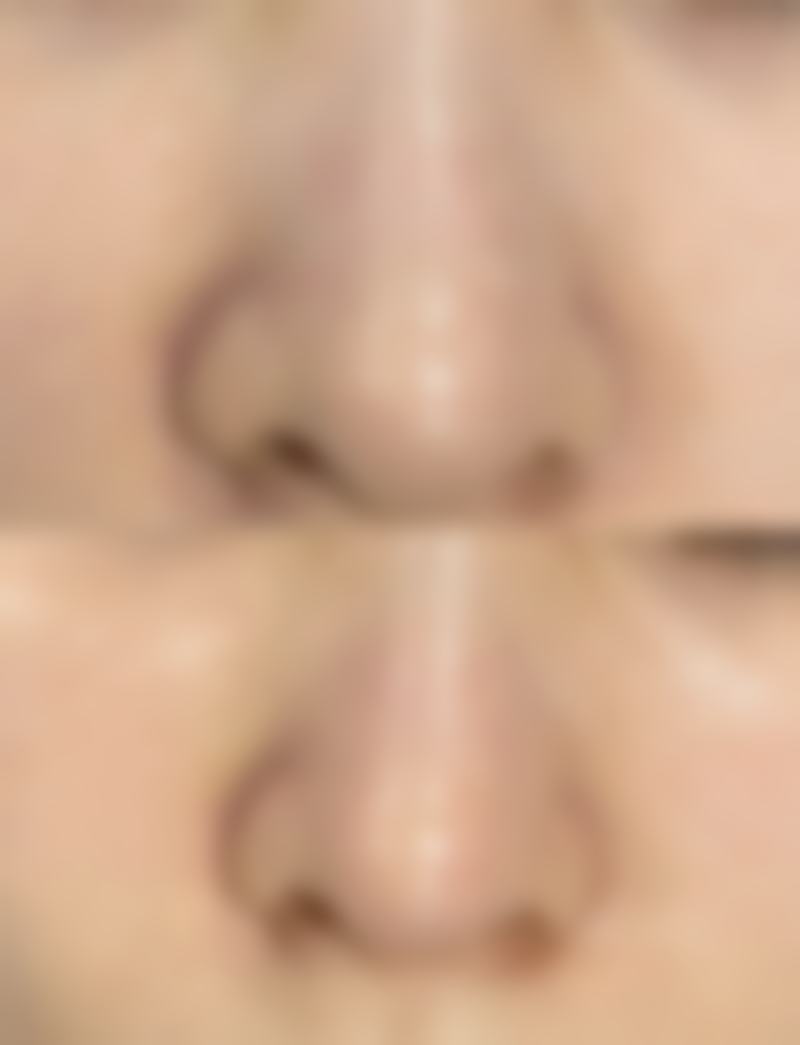 渭南凡尔赛明雅医疗美容诊所口碑评价怎么样？