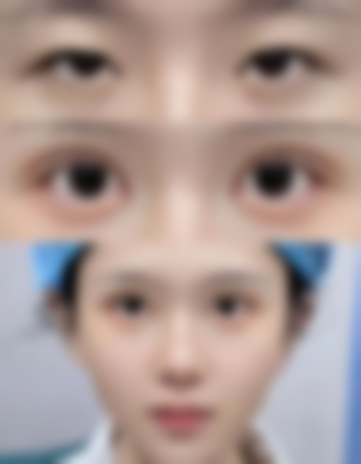 上海伯思立医疗美容口碑评价怎么样？