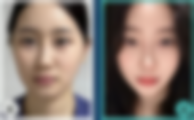 深圳欧维美创整形医院口碑评价怎么样？