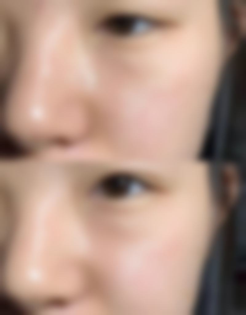 内蒙古呼和浩特薇格整形医院正规吗？