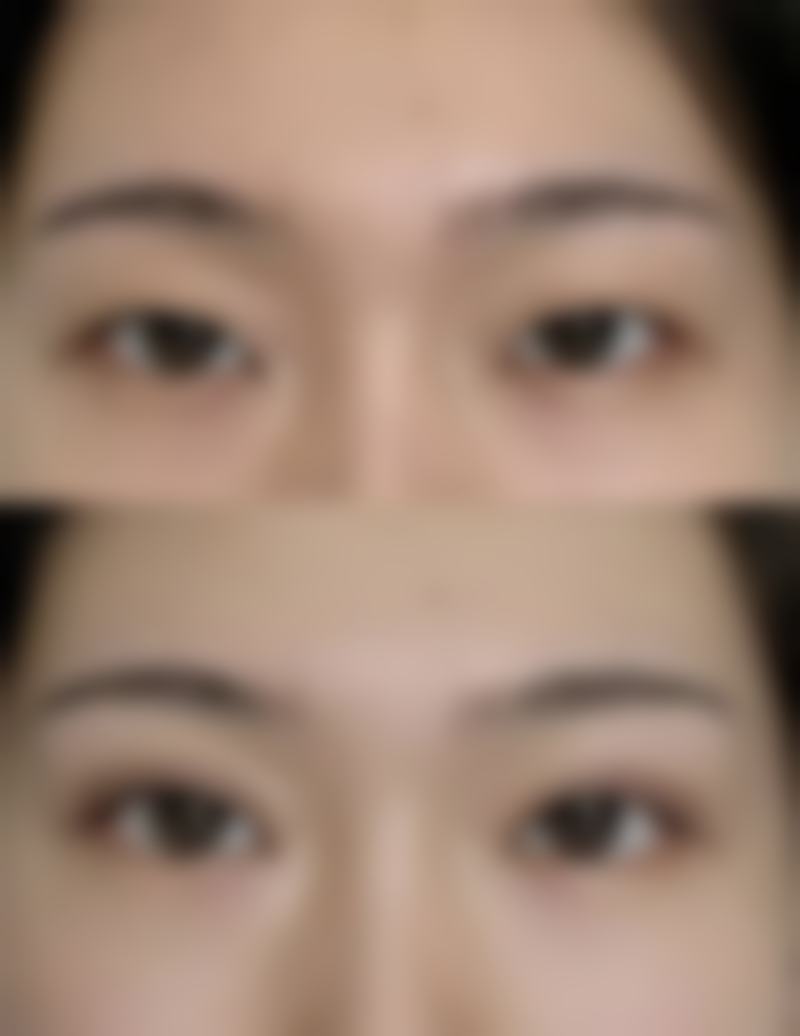 郑州顺柳姮美整形医院正规吗？