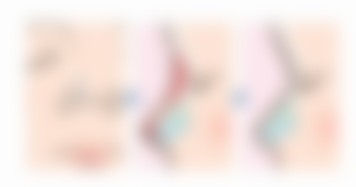 北京仁雁医疗美容门诊部口碑评价怎么样?