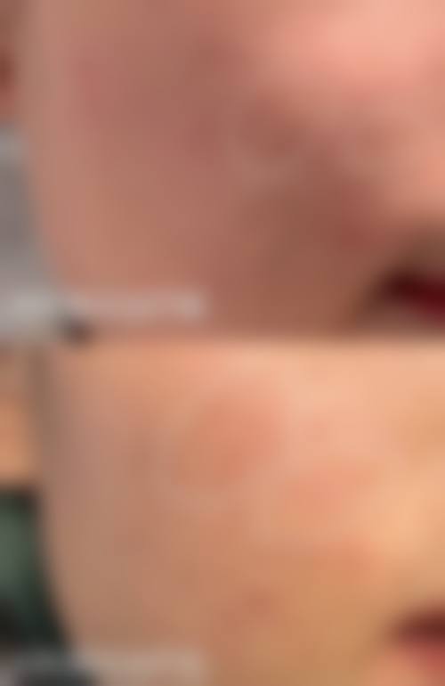 北京蓝海中医医院医疗美容科收费价格表