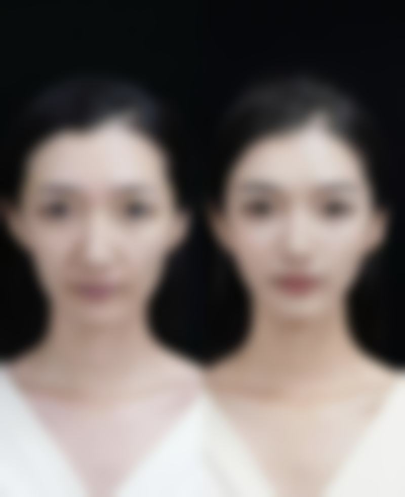 武汉斯启诺医疗美容门诊部王伟民：优质服务下的手术坚持