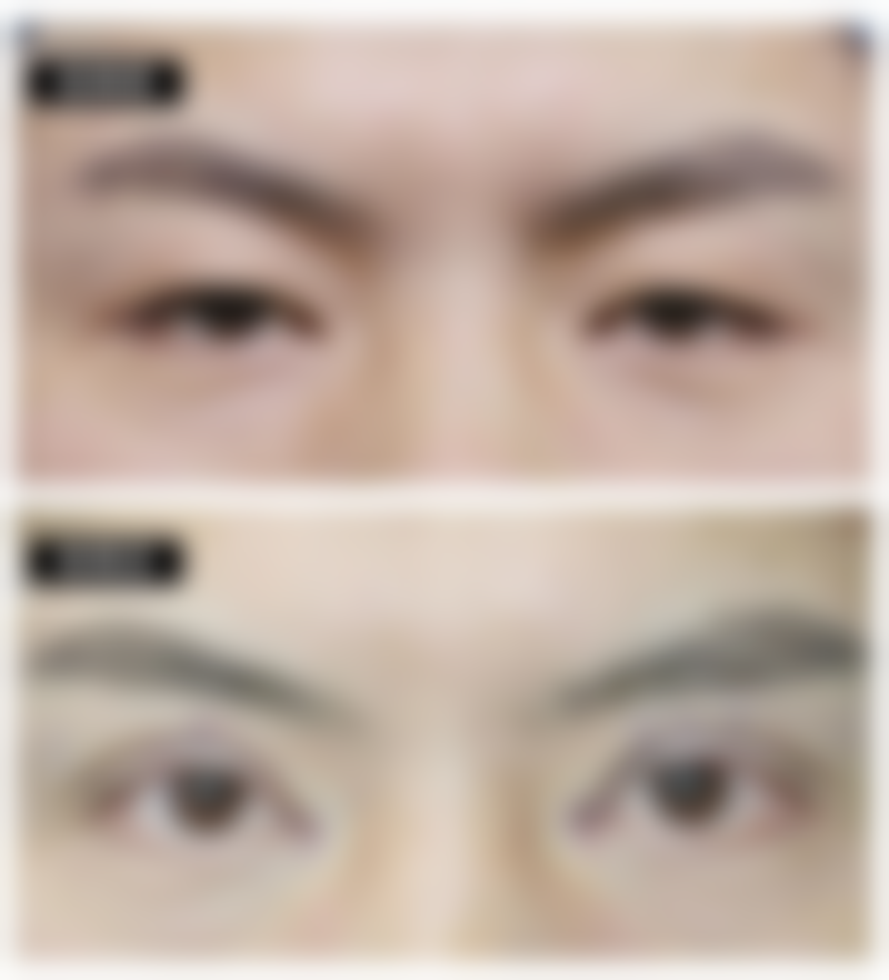 武汉斯启诺医疗美容门诊部彭华伟医生玻尿酸技术怎么样？