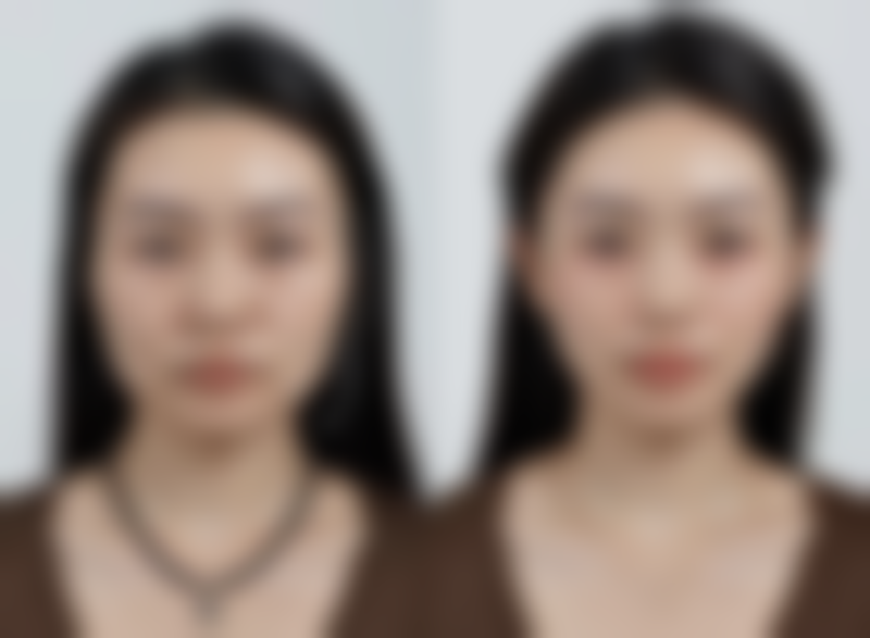 武汉斯启诺医疗美容门诊部叶锋:热门医美项目优势揭秘