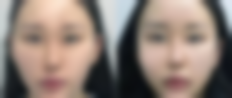 杭州纽博恩医疗美容诊所口碑评价怎么样？