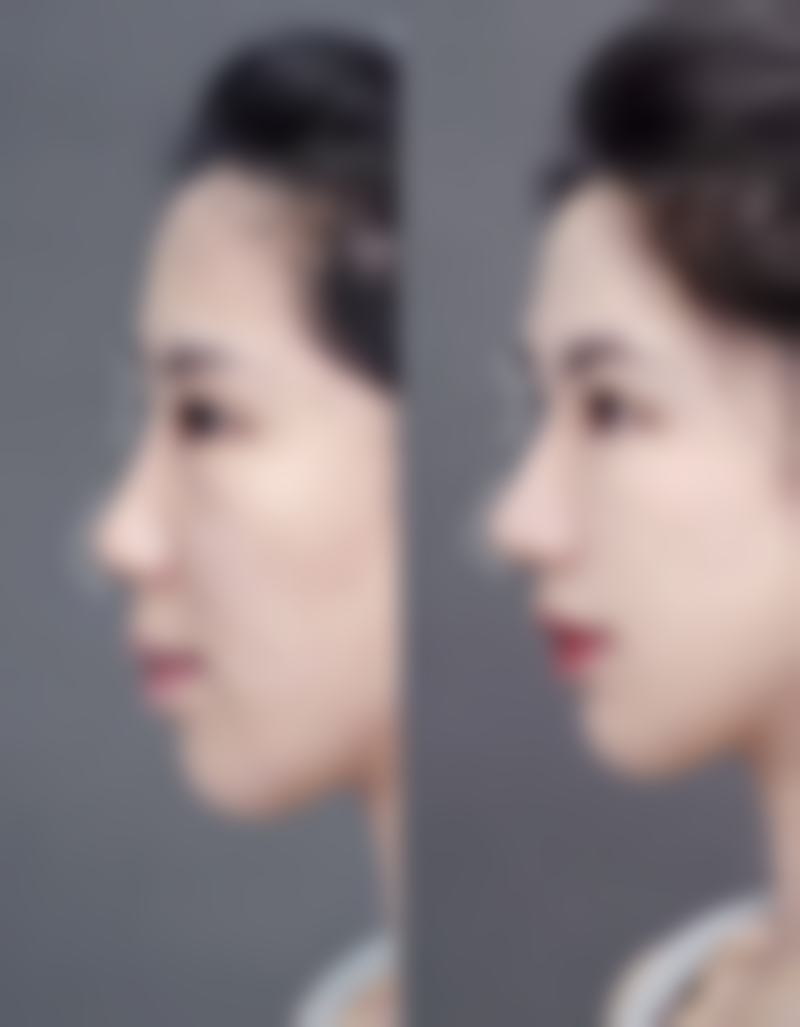 乌兰察布广秀医疗美容诊所口碑评价怎么样?