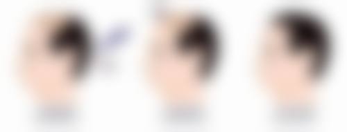 珠海美如初医疗美容诊所收费价格表