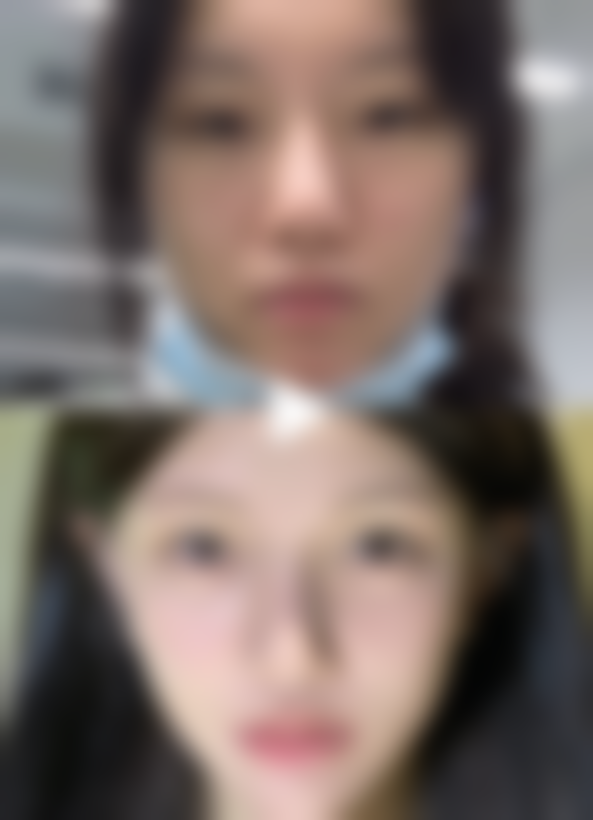 韩国GRIDA整形美容医院正规吗？