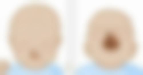 东莞唯美整形医疗美容医院怎么预约：