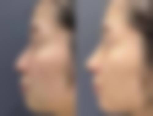 温州百佳东方医学美容医院口碑评价怎么样？