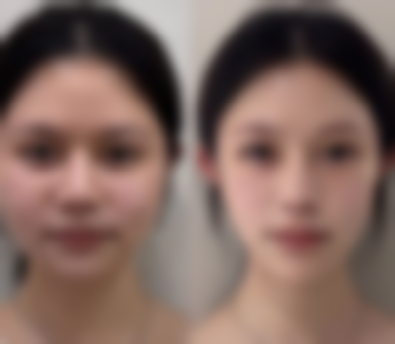 中山七院整形美容科正规吗?