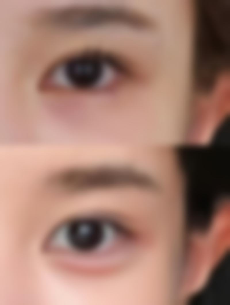 北京美易美时代整形医院怎么预约