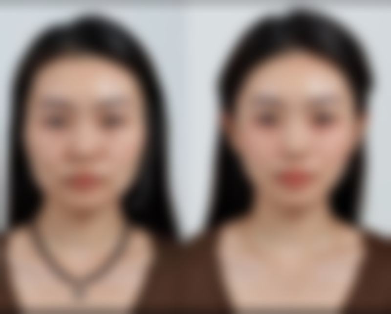 深圳爱氏医疗美容门诊部正规吗？