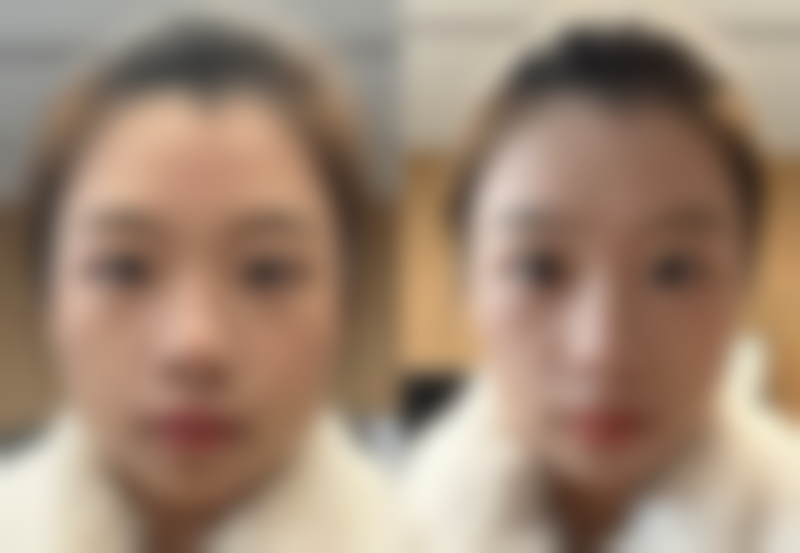 北京博美整形医院怎么预约