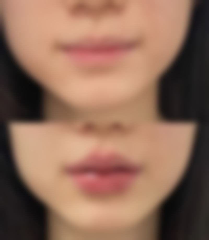 南充衡美整形医疗美容门诊部正规吗?