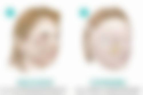 莆田维纳斯医疗整形美容医院怎么预约